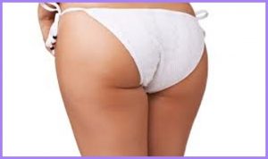 Sollevamento glutei